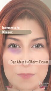 Tratamento de Olheiras: Diga Adeus às Olheiras Escuras