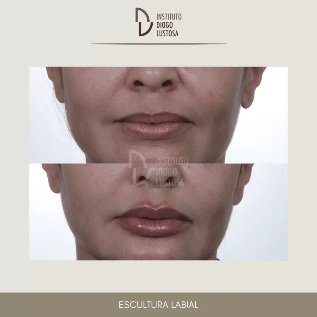 escultura labial