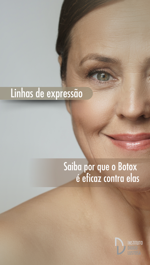 Botox para linhas de expressão: saiba como funciona