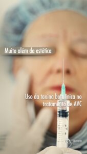 toxina botulínica no tratamento de AVC