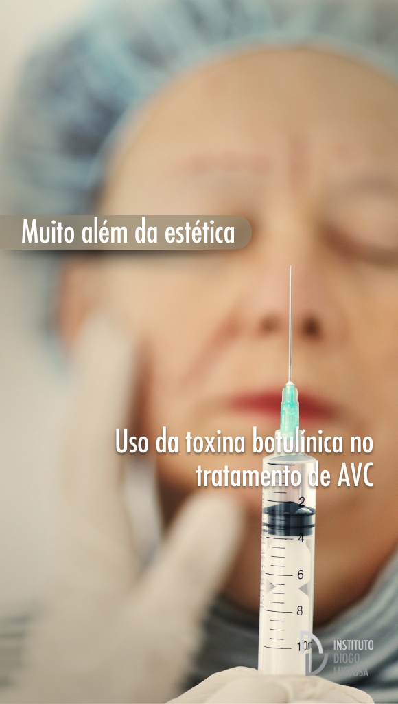 toxina botulínica no tratamento de AVC toxina botulínica no tratamento de AVC